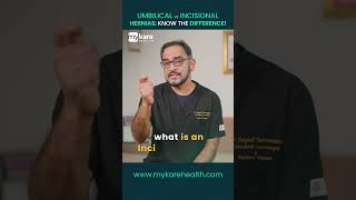 Umbilical vs incisional Hernia  Know the Difference  Mykare Health [upl. by Meean640]