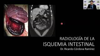 1  8 Radiología de la Isquemia Intestinal  Dr Cordova [upl. by Leksehc]