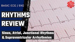 Basic ECG EKG Part 3 Sinus Atrial amp Junctional Rhythms and Supraventricular Arrythmias [upl. by Hestia559]