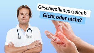 Geschwollenes Gelenk Gicht oder nicht [upl. by Iver905]