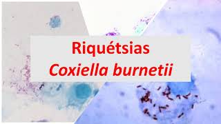 Microbiologia Médica Riquétsias e Coxiella burnetti [upl. by Kris]