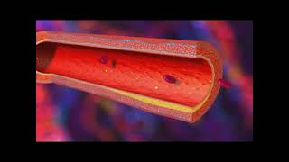 Infarctus du myocarde  IDM [upl. by Ashbey]