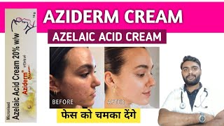 Azelaic acid cream  How to use azelaic acid cream  Best azelaic acid cream  Aziderm cream [upl. by Amisoc576]