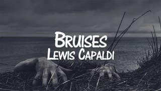 Lewis Capaldi  Bruises Sub Español [upl. by Aihsemat]