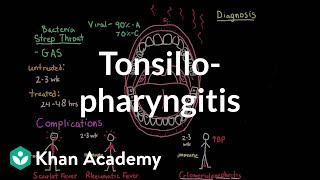 Tonsillopharyngitis  Complications diagnosis and treatment  NCLEXRN  Khan Academy [upl. by Werdma228]