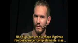 Uma Grande História de Superação  Nick Vujicic [upl. by Silvers]