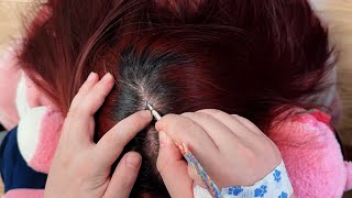 ASMR Dandruff Clearing A CombThrough Scalp Care Journey [upl. by Acinat]