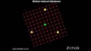 Motioninduced blindness test for the severity of ADHD  eChalk illusion [upl. by Cchaddie807]