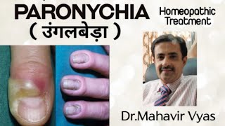 Paronychia  उंगलबेड़ा  Homeopathic Treatment  DrMahavir Vyas [upl. by Akienaj915]