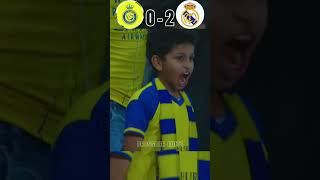 Ronaldo Injured And Mbappe Cry  Al Nassr VS Real Madrid Imaginary Final  ronaldo vs mbappe [upl. by Meingolda]