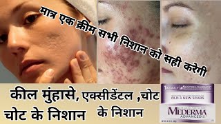 mederma cream kaise use karescar removal cream healthtips medicinemanishpharmcybala YouTube [upl. by Yaral453]