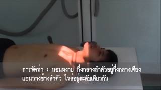 Cervical Vertebrae  Anteroposterior ProjectionOttonello Method [upl. by Dace539]