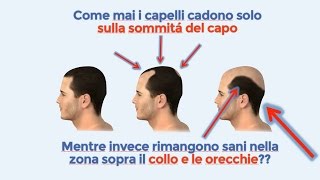 Rimedi per la caduta dei capelli Questo é il miglior metodo anti calvizie in assoluto [upl. by Kingsbury]