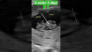 8 Weeks 5 Days Ultrasound Babys First Heartbeat and Development [upl. by Meehahs]