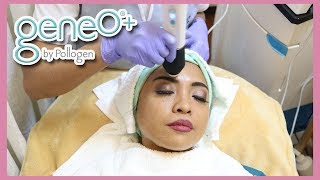 My OXYGENEO 3in1 TriPolar The SUPER FACIAL Experience  Genzel De las Alas [upl. by Olva]