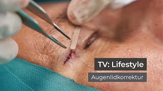 lifestyle Augenlidkorrektur  skinmed  Plastische und Ästhetische Chirurgie und Dermatologie [upl. by Enomas]