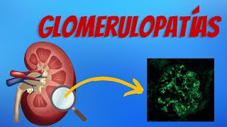 Glomerulopatías Explicadas Claramente [upl. by Martynne]