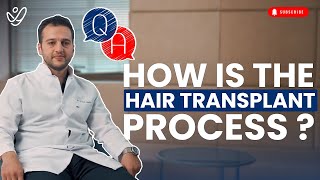 How is the Hair Transplant Process [upl. by Jephthah]