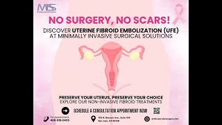 Surgery for Fibroids Theress a Better Option [upl. by Lunt]