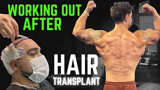 FUE Hair Transplant How Long Should You Wait to Work Out After the Surgery [upl. by Coster]