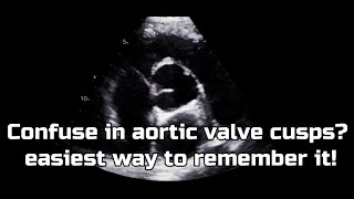 Aortic valve cusps  Label it in easiest way [upl. by Meares432]