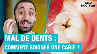 🦷 Comment soigner une CARIE  Les réponses du Dr Jimmy Mohamed [upl. by Alegnat119]