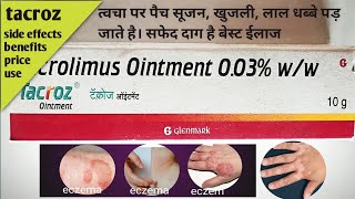 Tacroz Ointment  Tacrolimus 003 Ointment  Tacroz Ointment Uses Benefits tacroz ointment in hindi [upl. by Eylloh]