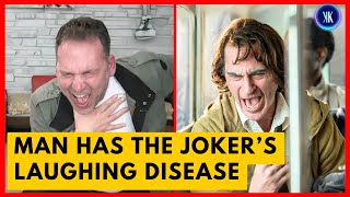 This Man Has The Same Laughing Disease As The Joker [upl. by Kliman]