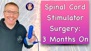 Spinal Cord Stimulator Surgery 3 Months Post Surgery Update [upl. by Letreece566]