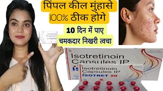 एक्ने पिंपल कभी नही होगा ये गोली खाओ isotretinoin capsules ip 20 mg  acne pimples treatment [upl. by Pulling]