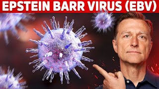 The 5 Things You MUST Know about EpsteinBarr Virus EBV [upl. by Thessa]