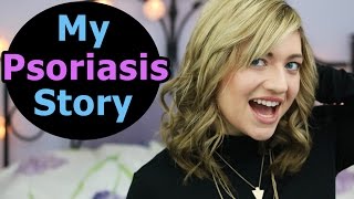 MY PSORIASIS STORY  Psoriasis Treatment Psoriasis Diet Positive Affirmations  Guttate Psoriasis [upl. by Eelessej]