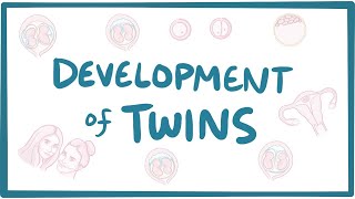 Development of twins [upl. by Aneek]