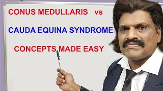 CONUS MEDULLARIS vs CAUDA EQUINA SYNDROME CONCEPTS MADE EASY [upl. by Annaiuq]