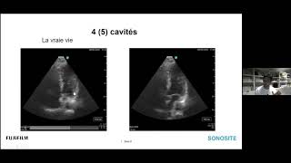 Webinaire Echographie thoracique en Anesthésie [upl. by Assitruc]