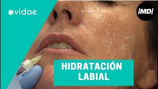 Tratamiento para la hidratación de labios [upl. by Nylarak312]