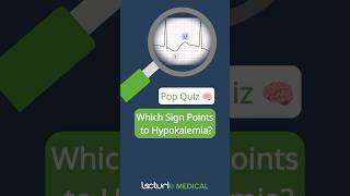 Quiz Time 📊 Identify the Hypokalemia Sign on EKG [upl. by Joya]