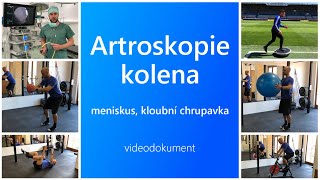 Artroskopie kolena  videodokument  průvodce po ošetření menisků a kloubní chrupavky [upl. by Anem]