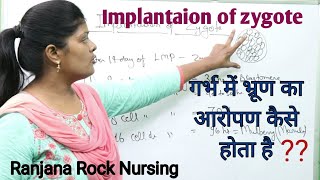 What is Implantation by Ranjanaअंडे का गर्भ में आरोपण होनाFunction of trophoblast hartmans sign [upl. by Kandy633]