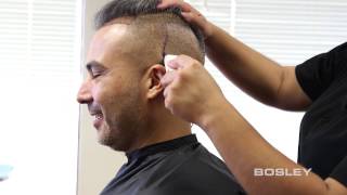 BOSLEY FUE Follicular Unit Extraction HairbyHair Restoration from Bosley How its done [upl. by Artemisa]