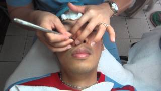 Facial w Diamond Peel amp NonSurgical Face Lift Treatment Part 37 [upl. by Kristel]