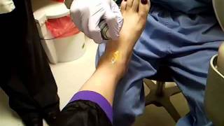 ankle cortisonesteroid pain management injection Dec 16 2011 [upl. by Novaat]