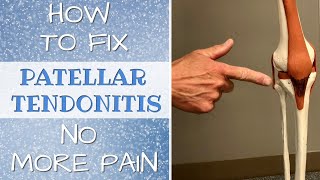 How To Fix Patellar Tendonitis No More Pain amp Self Treatment [upl. by Akeemat]