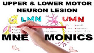 Upper amp Lower Motor Neuron Lesions  Mnemonic series 5 [upl. by Messing969]