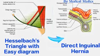 Hesselbachs Triangle  Anatomy of Inguinal Triangle Simplified  Medical Medics [upl. by Orodisi]