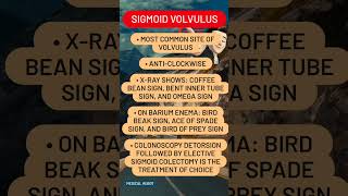 Sigmoid volvulus [upl. by Purcell]