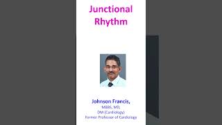 Junctional Rhythm [upl. by Annat]