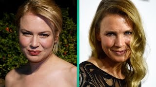 What Did Renee Zellweger Do to Her Face Plastic Surgeon Weighs In [upl. by Enneite332]