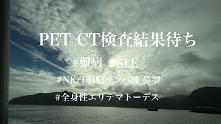 【PET CT検査結果待ち】NKT細胞リンパ腫鼻型SLE膠原病難病全身性エリテマトーデスPETPETCT [upl. by Perlis]