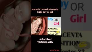 placenta posterioranterior baby boy or girl [upl. by Utica]